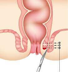 Tibbiy porno tajribalar